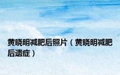 黄晓明减肥后照片（黄晓明减肥后遗症）