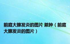 前庭大腺发炎的图片 脓肿（前庭大腺发炎的图片）