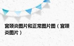 宫颈炎图片和正常图片图（宫颈炎图片）