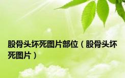 股骨头坏死图片部位（股骨头坏死图片）
