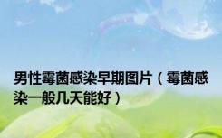 男性霉菌感染早期图片（霉菌感染一般几天能好）