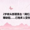 2岁娃头部遭重击！网红产品被曝缺陷……已有多人受伤