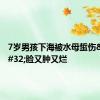 7岁男孩下海被水母蜇伤&#32;脸又肿又烂