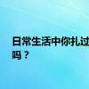 日常生活中你扎过电针吗？